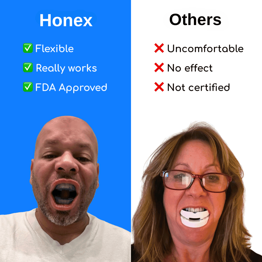 The Silent Sleep™ Anti-Snoring Mouthpiece Universal Size
